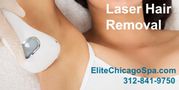 Full Body Laser Hair Removal Chicago